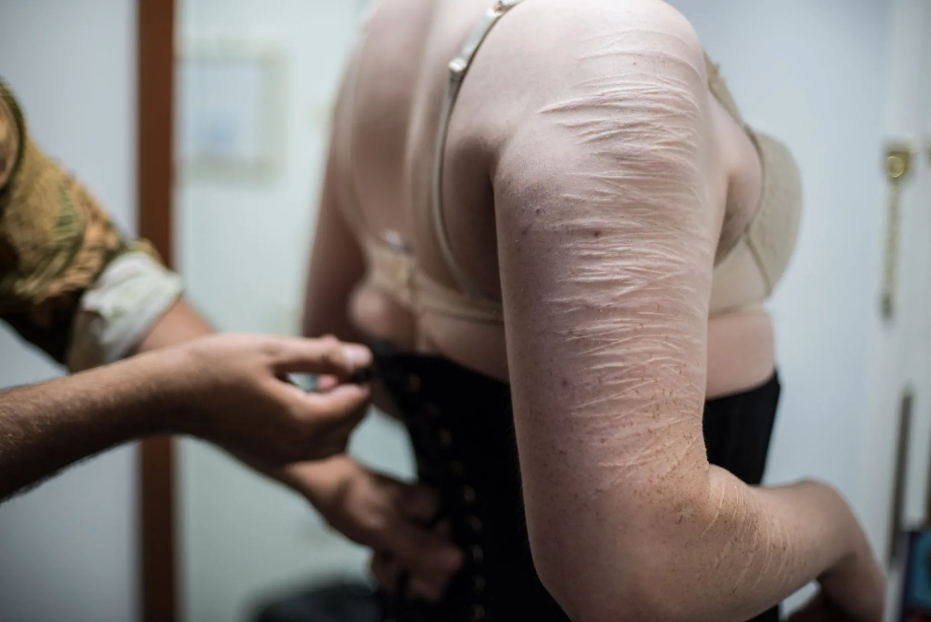 Soren preparing for drag performance, arm shows a history of self harm